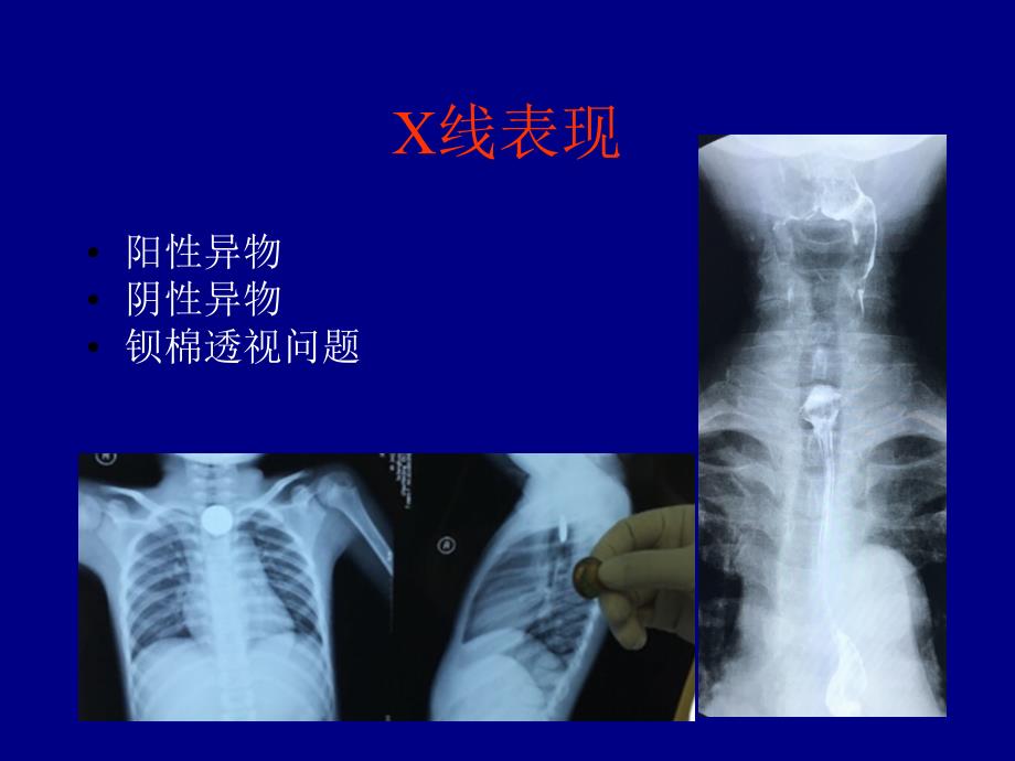 课2食管胃常见病ppt课件_第4页