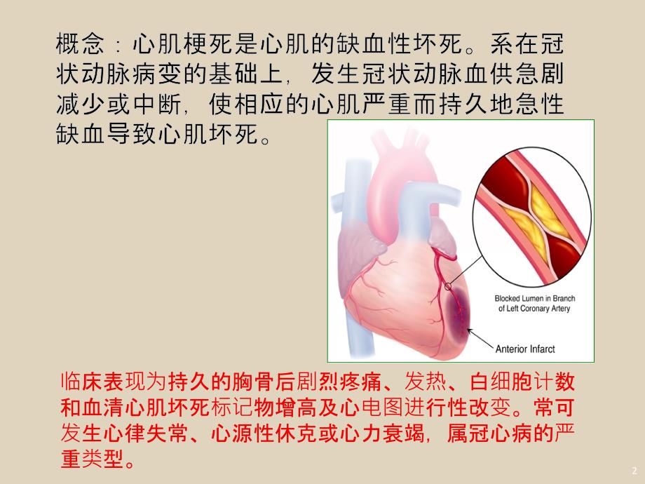 （精选课件）心肌梗死的护理常规_第2页