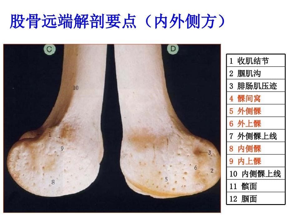 膝关节应用解剖_第5页