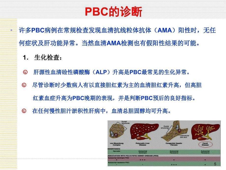 原发性胆汁性肝硬化诊治指南_第5页