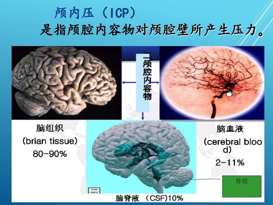 外科护理学第十四章-颅内压增高病人的护理课件_第5页