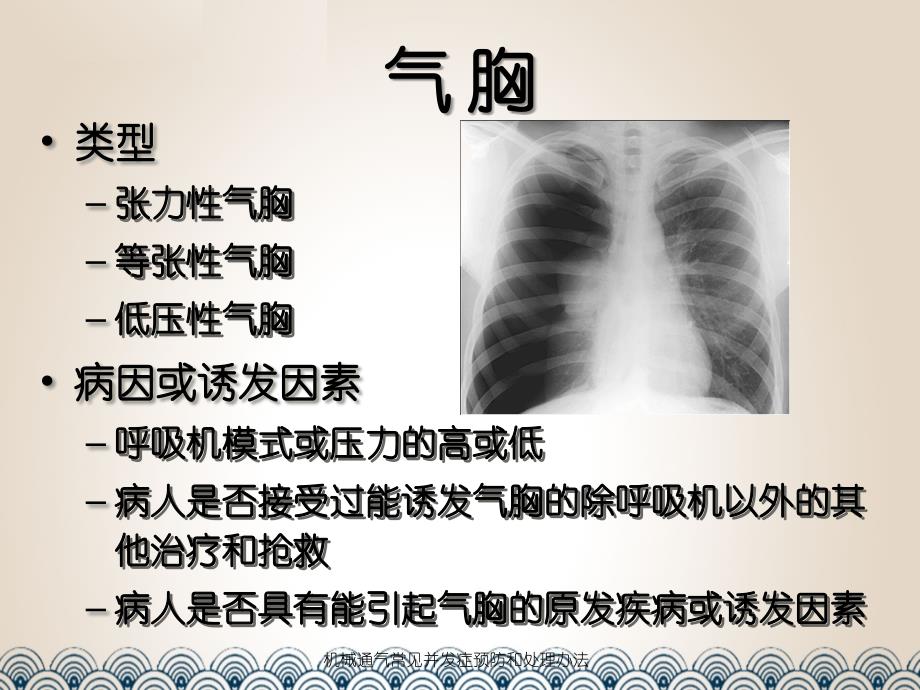 机械通气常见并发症预防和处理办法课件_第3页