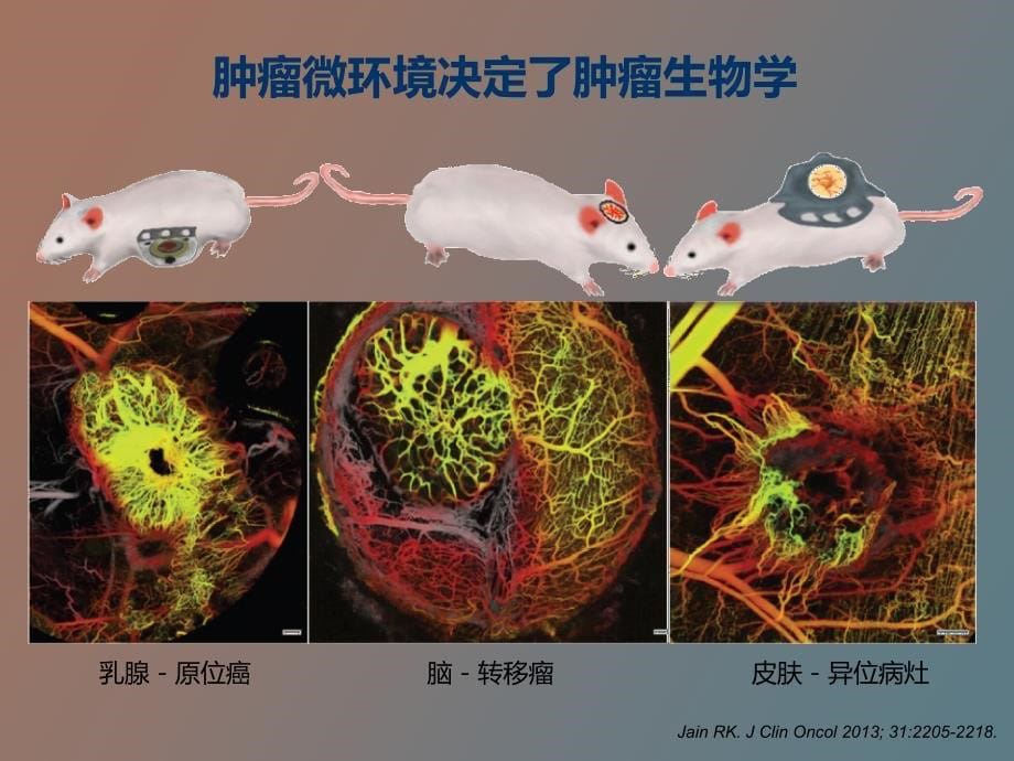 肿瘤微环境与抗血管生成_第5页