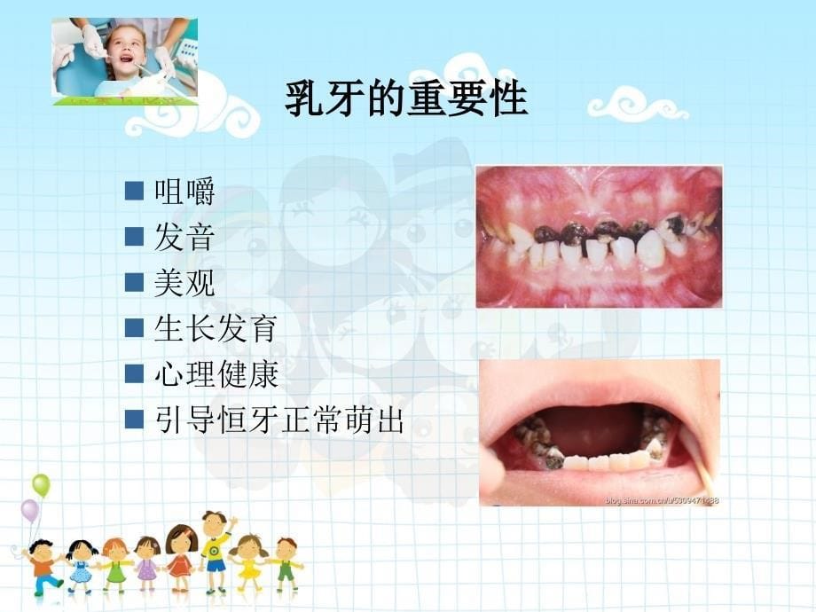 小学生口腔卫生宣教课件_第5页