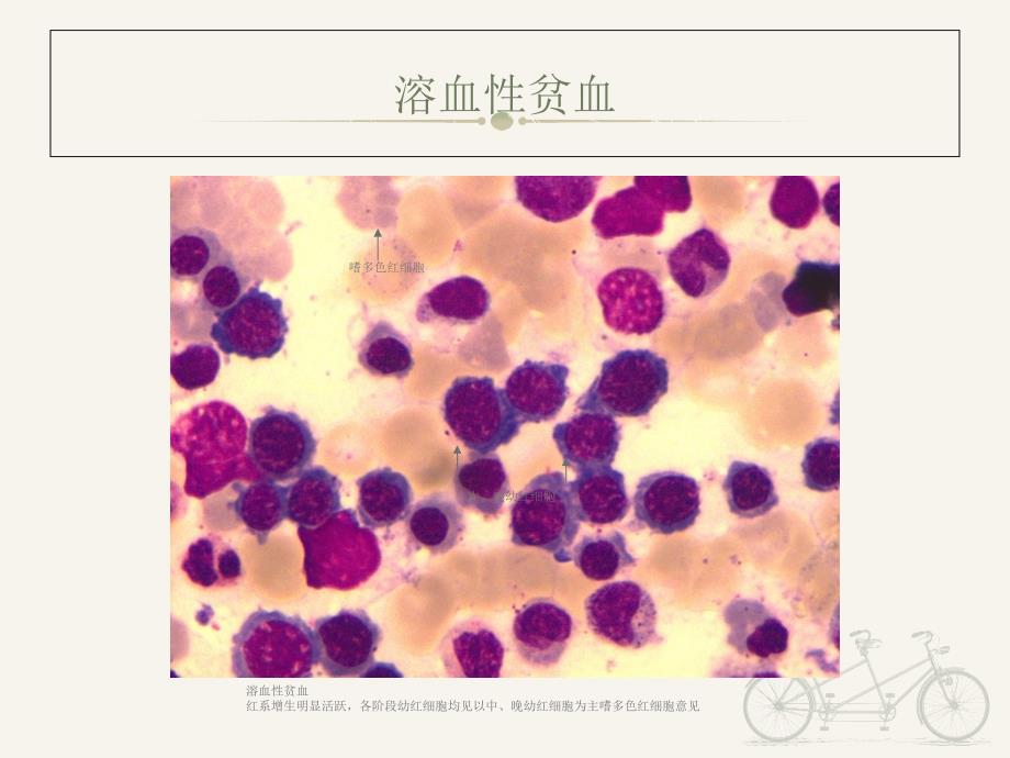 《诊断学》血液学检验图谱--课件_第3页