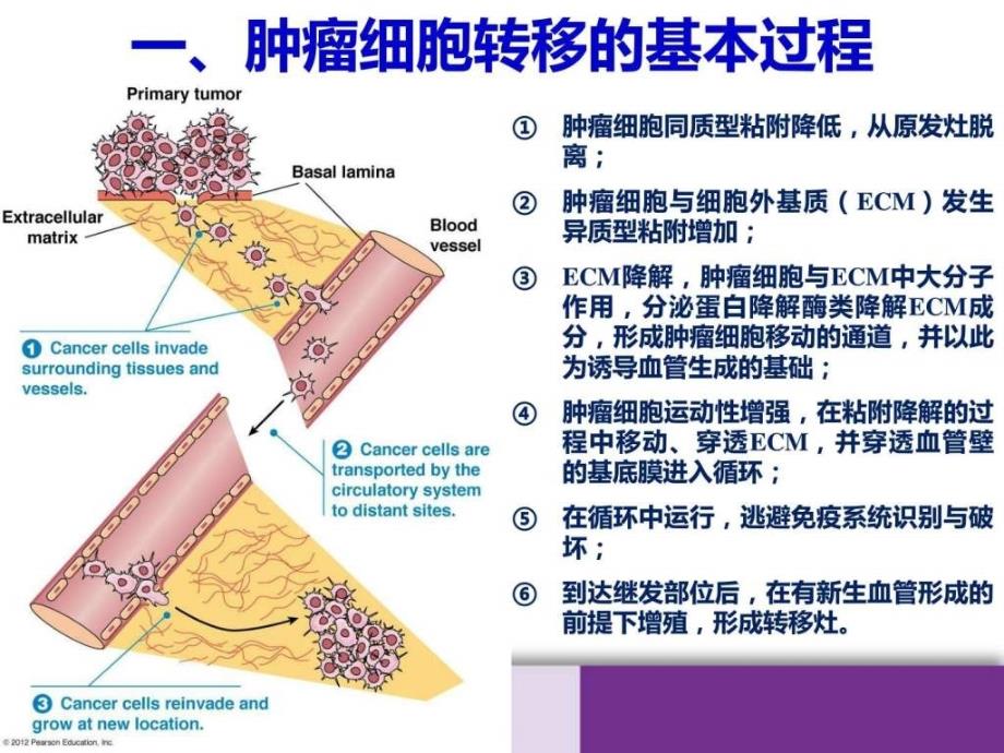 乳腺癌侵袭与转移PPT图文.ppt_第4页