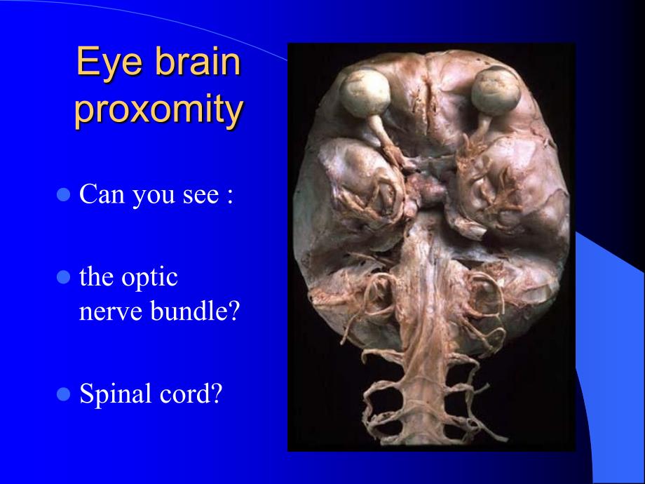 学英语眼睛TheEye课件.ppt_第2页