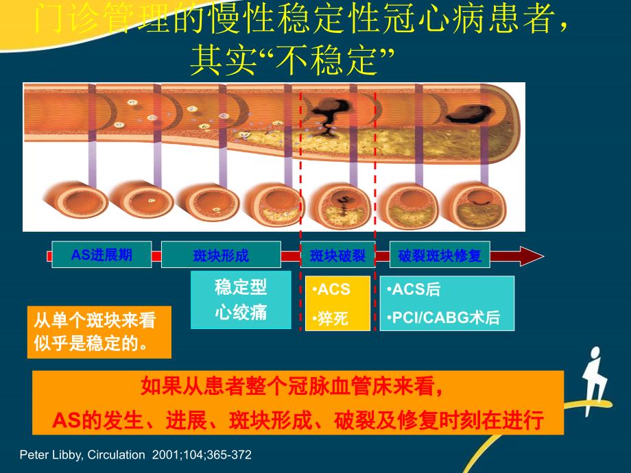 慢性稳定性冠心病长期他汀管理策略_第4页