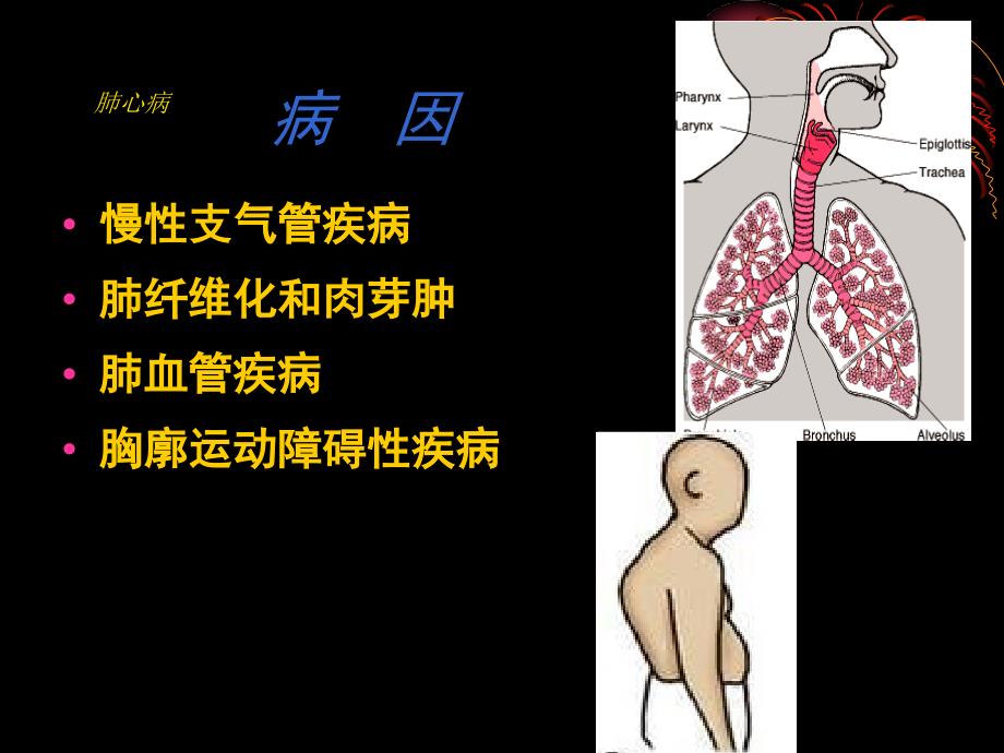 慢性肺源性心脏病患者的护理_第4页