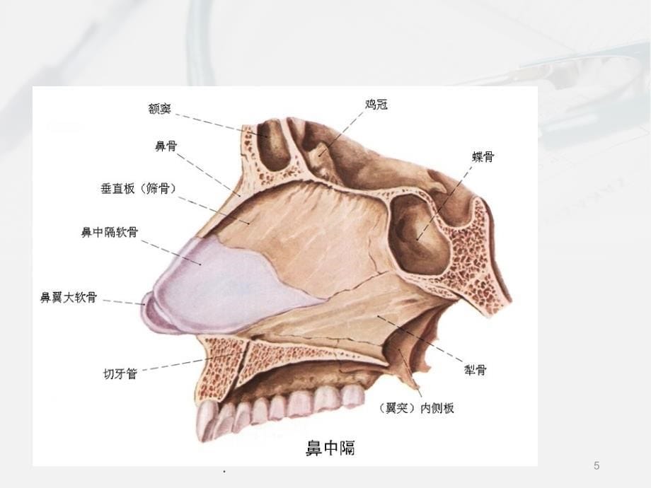 鼻中隔偏曲围手术期护理ppt演示课件_第5页