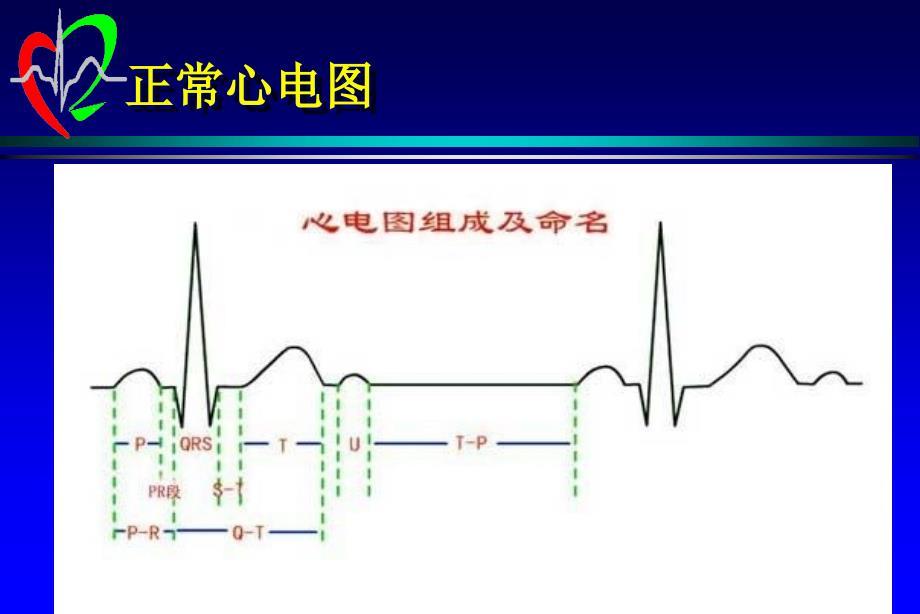 急性冠脉综合征的药物治疗_第4页