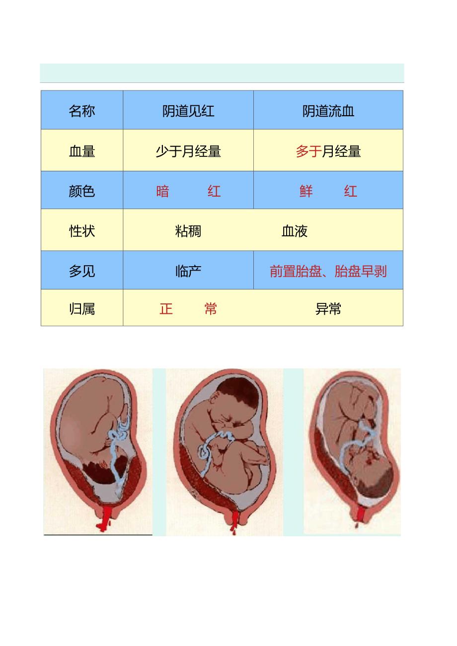 孕妇学校课程-自然分娩._第5页