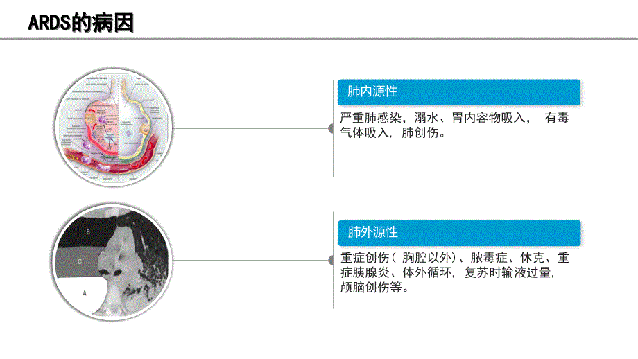 俯卧位通气的护理_第4页