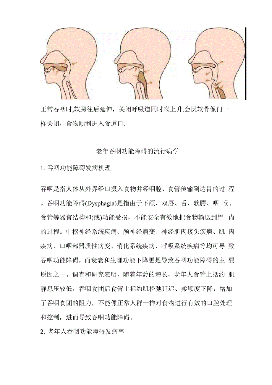 特医食品增稠组件在老年吞咽功能障碍患者中的使用_第3页