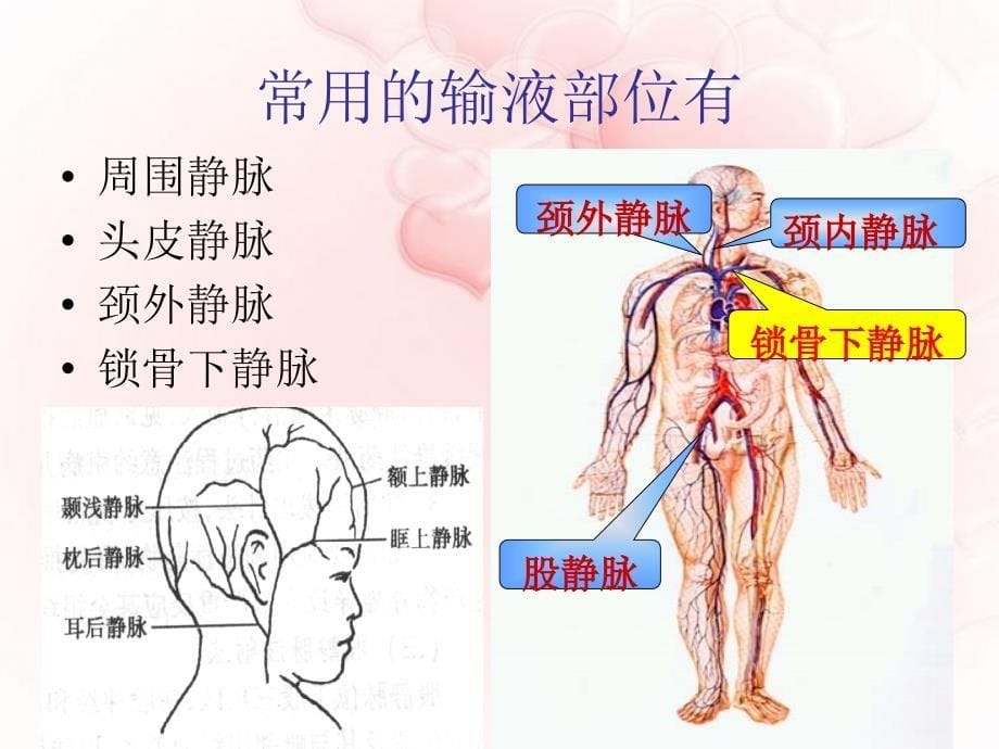 颈静脉穿刺术2 ppt课件_第5页