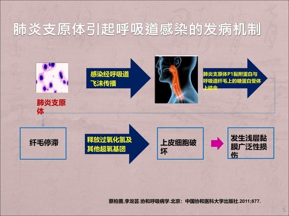 特殊病原体肺炎教学ppt课件_第5页