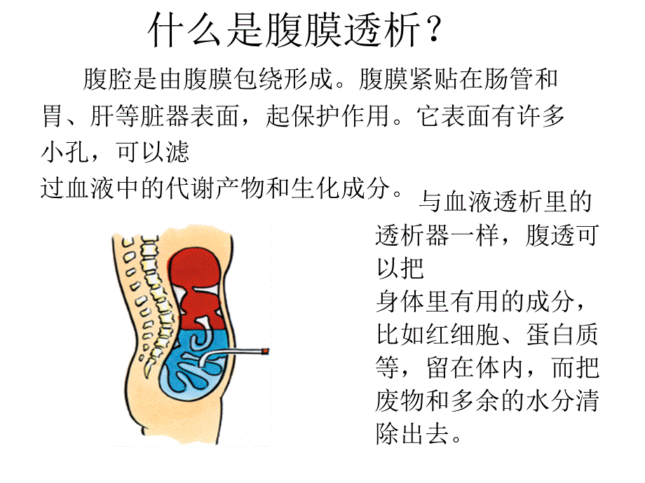 腹膜透析的护理_第4页