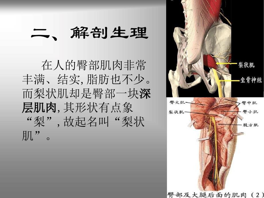 梨状肌综合征课件.ppt_第3页