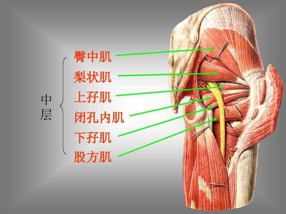 梨状肌综合征课件.ppt_第5页