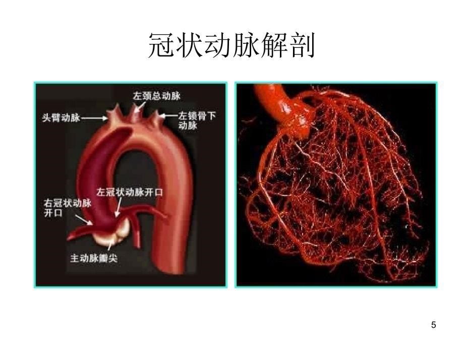 心血管常用介入诊疗参考PPT_第5页