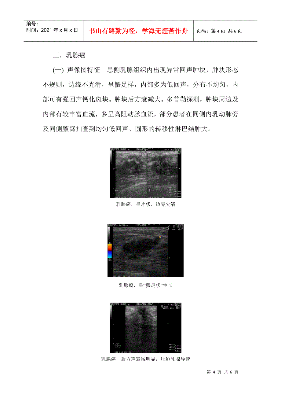 乳腺疾病诊断_第4页