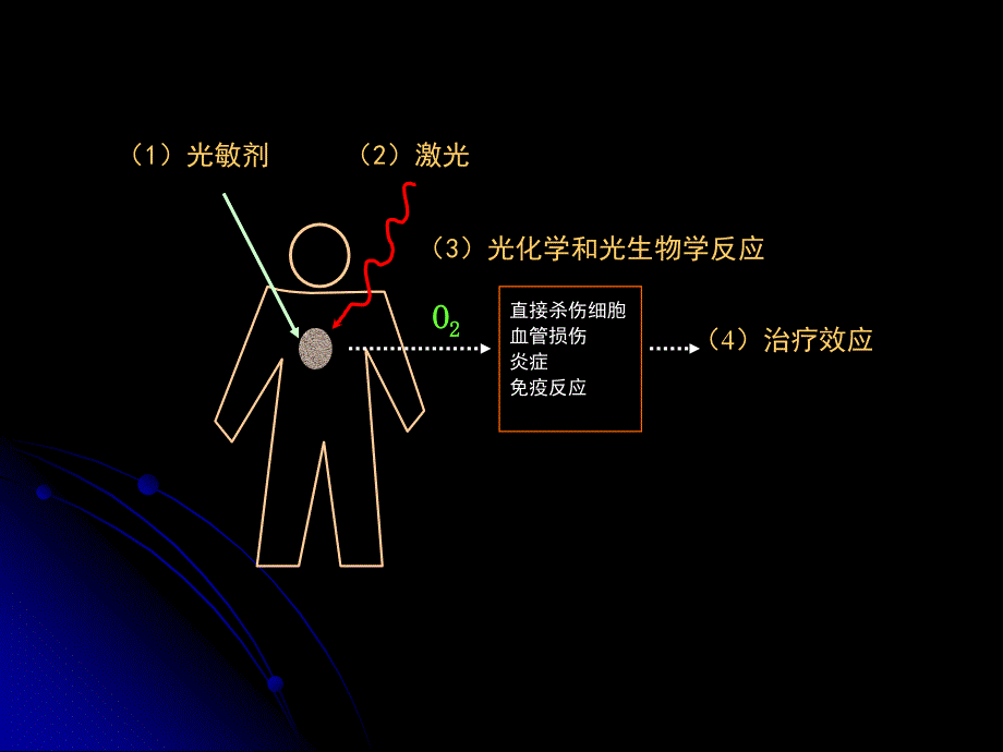 第五篇光动力学疗法ppt课件_第4页