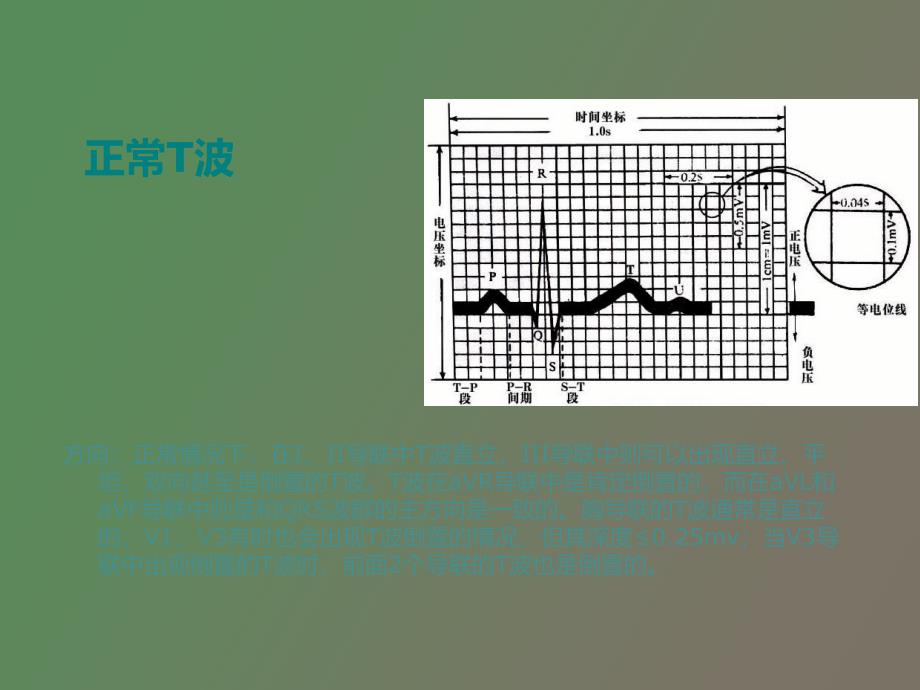 波假性正常化_第3页