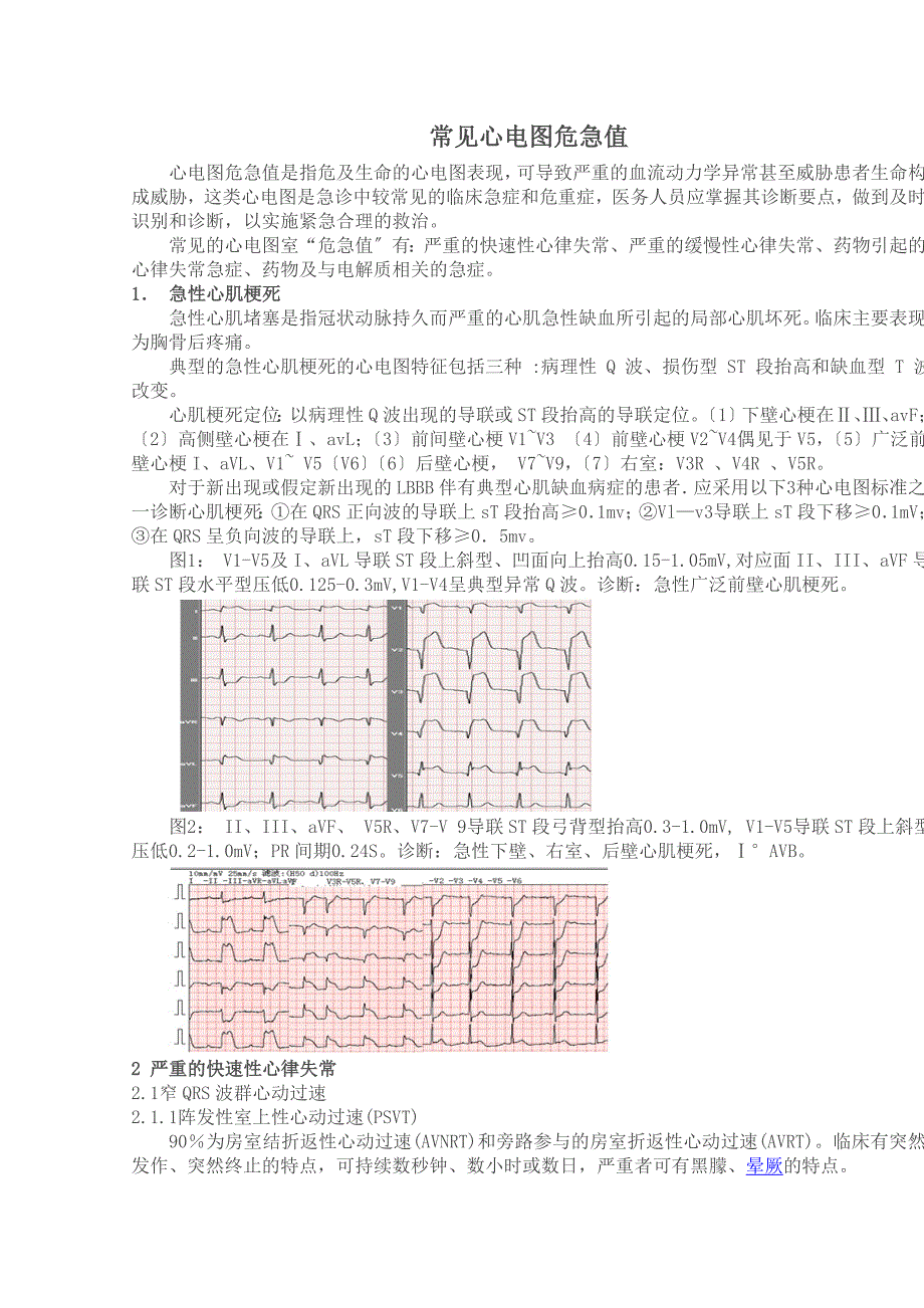 常见的心电图“危急值”_第1页