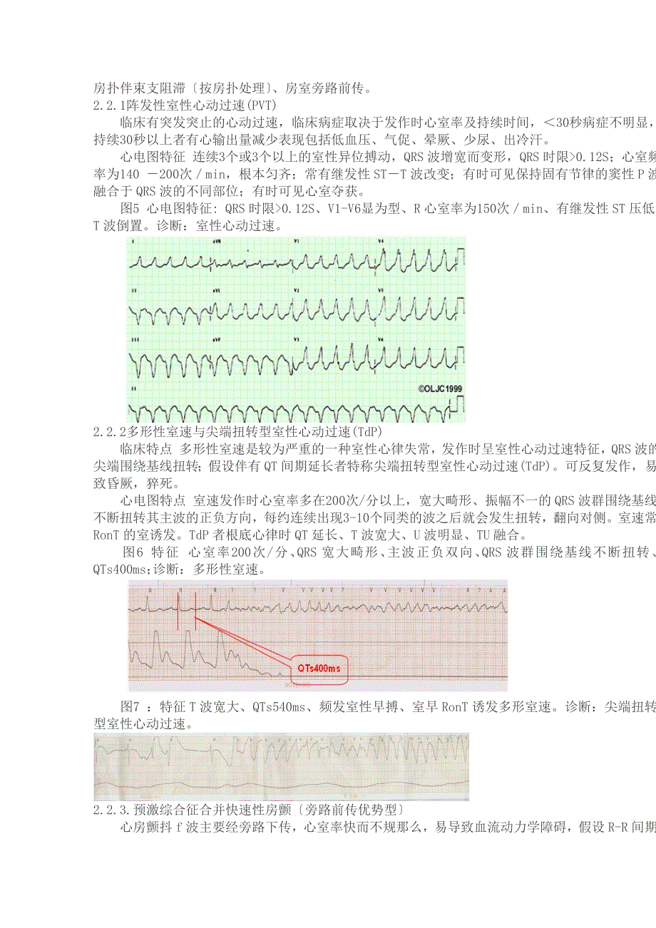 常见的心电图“危急值”_第3页