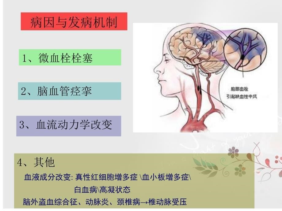 短暂性脑缺血发作病例分析_第5页