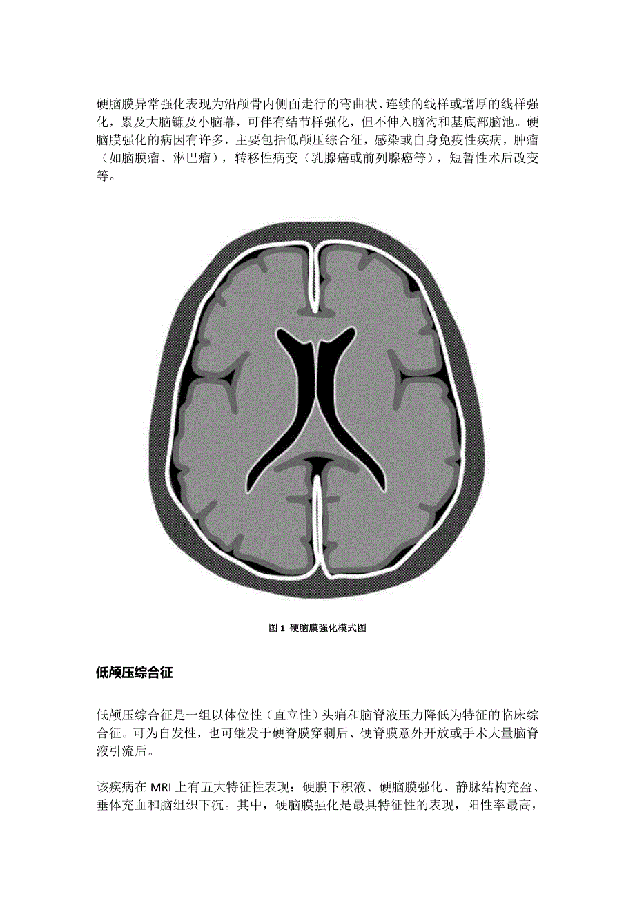 脑膜强化的常见类型与鉴别诊断_第2页