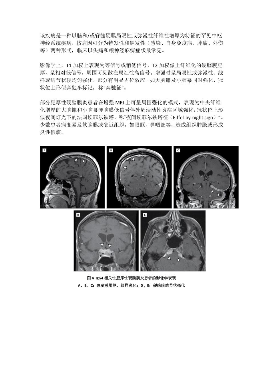 脑膜强化的常见类型与鉴别诊断_第4页