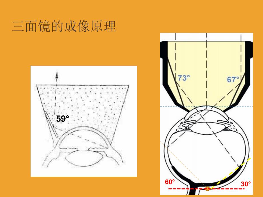 三面镜检查PPT精选文档_第4页