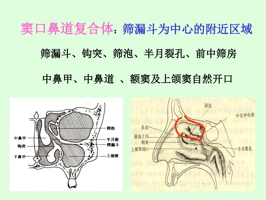 耳鼻咽喉－头颈外科：急性鼻窦炎_第4页