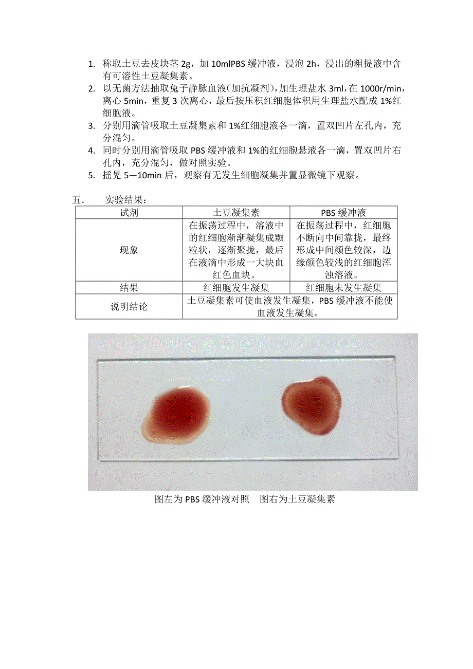 细胞凝集反应实验报告_第2页