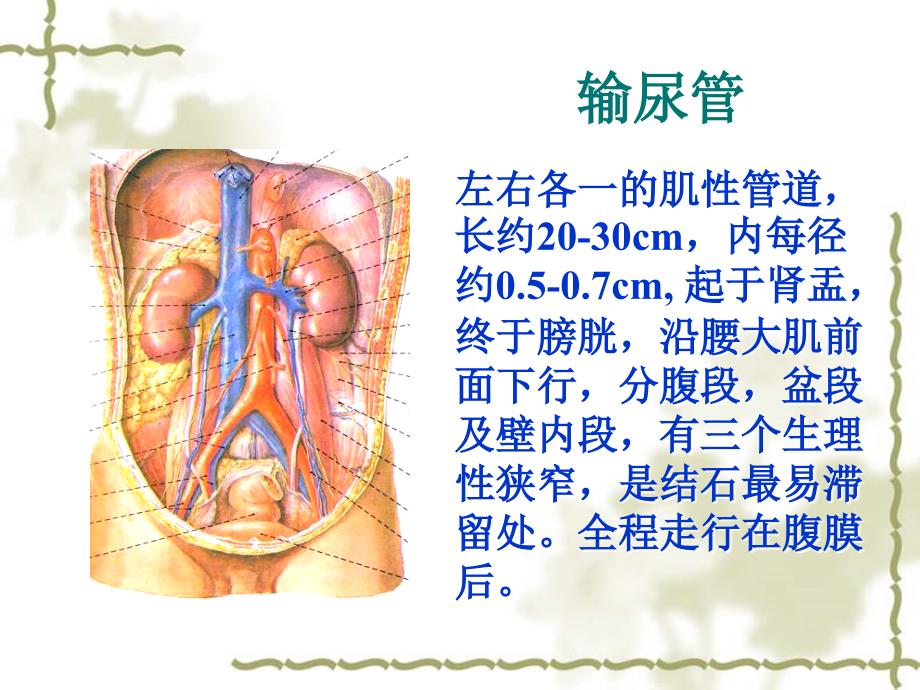 泌尿系结石梗阻_第4页