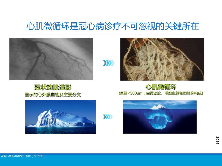 小讲课冠脉微血管病变_第4页