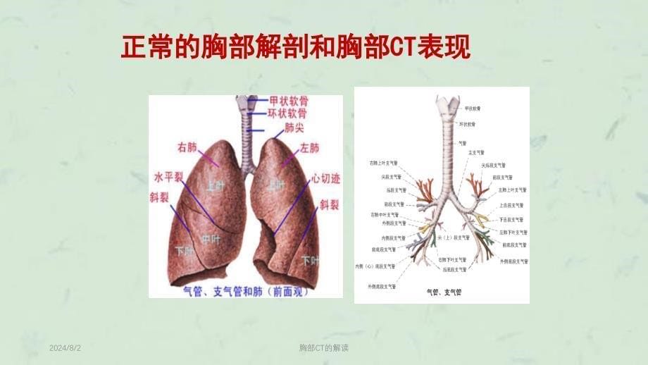 胸部CT的解读课件_第5页