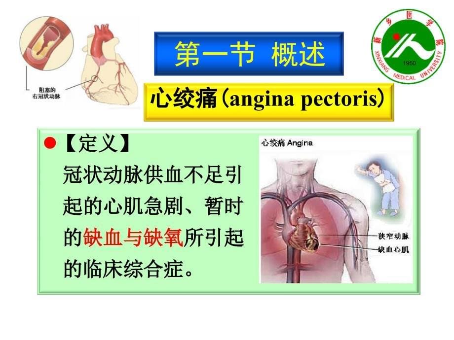 ★抗心绞痛药物2学时_第5页