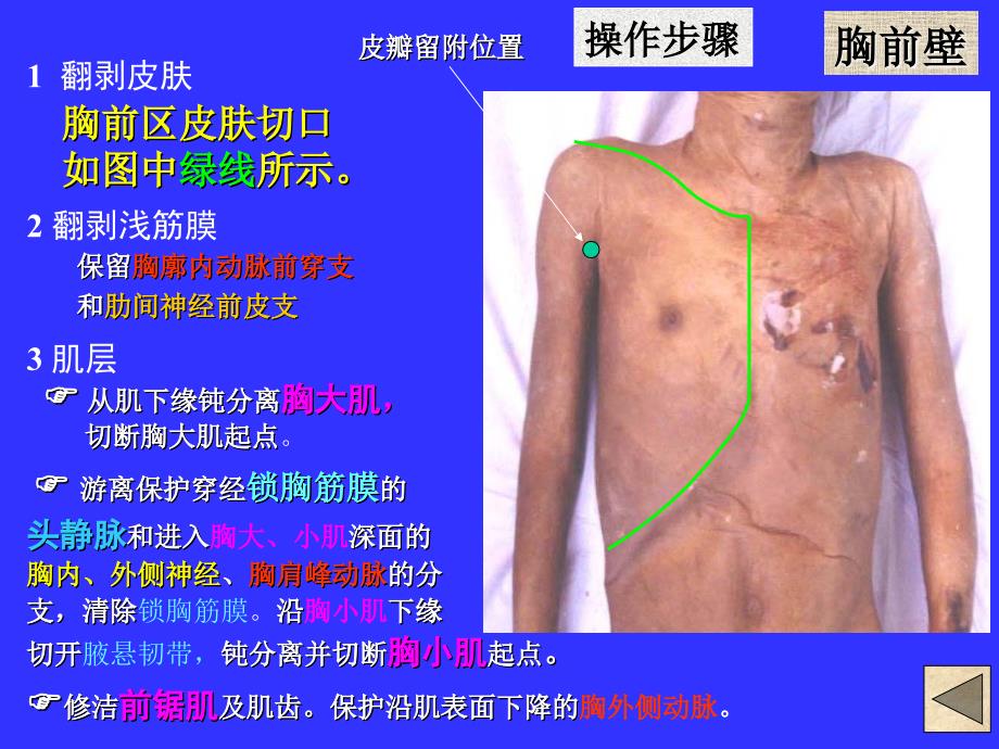 《局解操作上肢》PPT课件_第2页