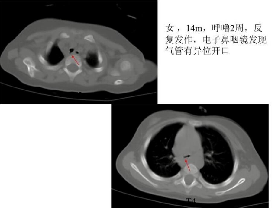 儿科先天发育异常_第3页