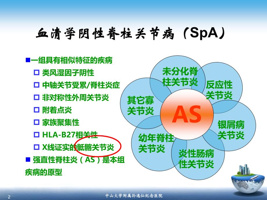 医学影像-SpA骶髂关节炎的影像学诊断与鉴别诊断课件_第2页