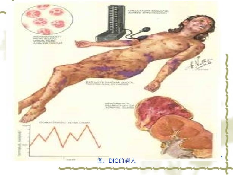 《图DIC的病人》PPT课件_第1页