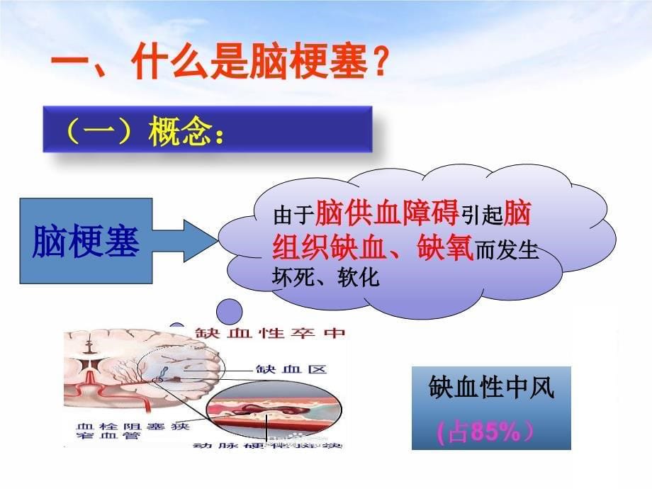 脑梗塞患者健康教育.ppt_第5页