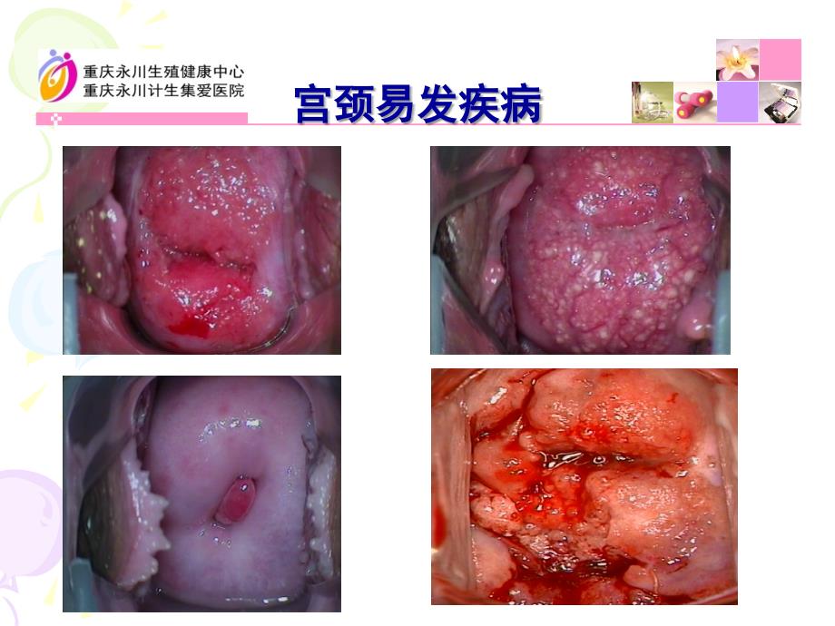 最新健康宫颈PPT文档_第3页