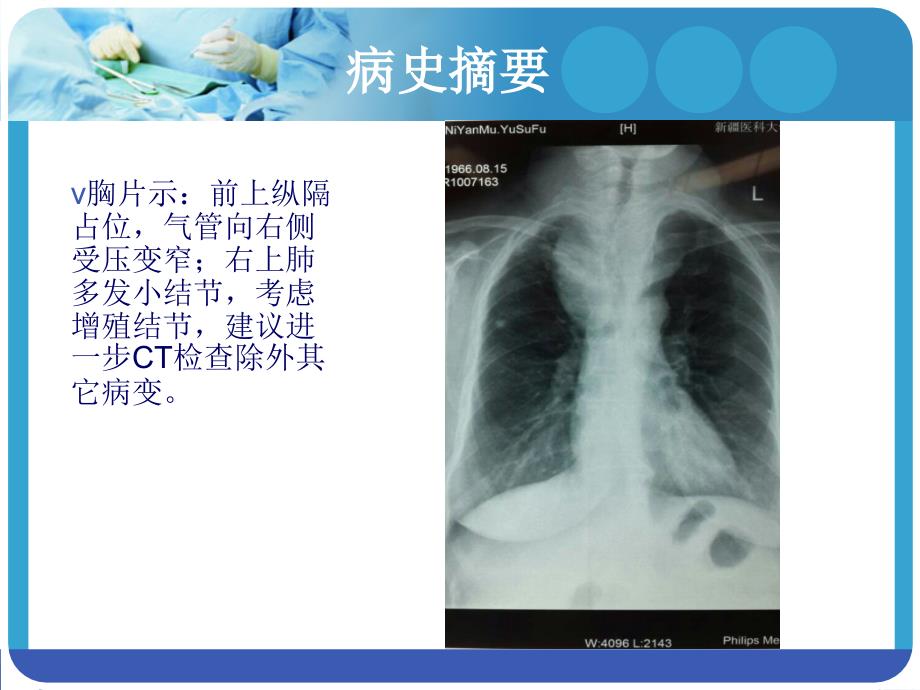 巨大甲状腺肿麻醉PPT课件_第4页