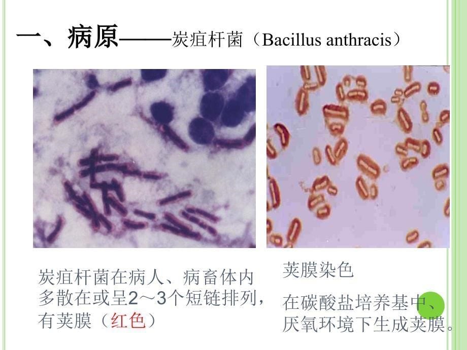 炭疽检验技术PPT课件_第5页