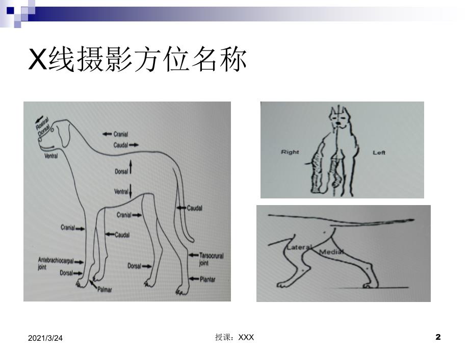 X线摄影之摆位PPT课件_第2页