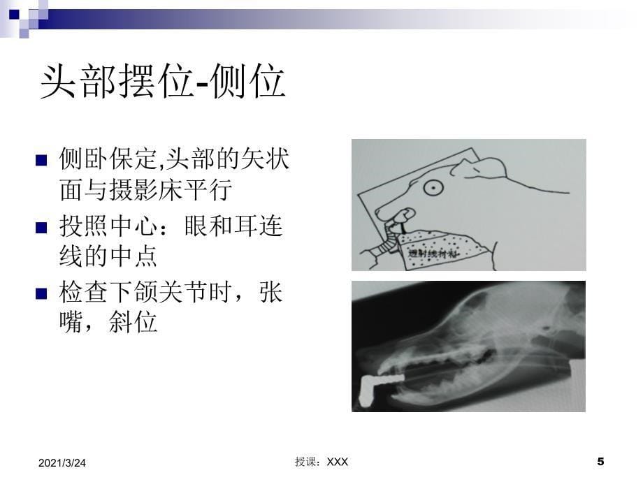 X线摄影之摆位PPT课件_第5页