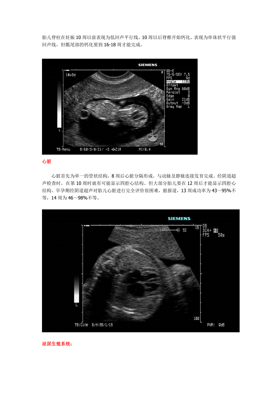 胎儿超声讲座.doc_第4页